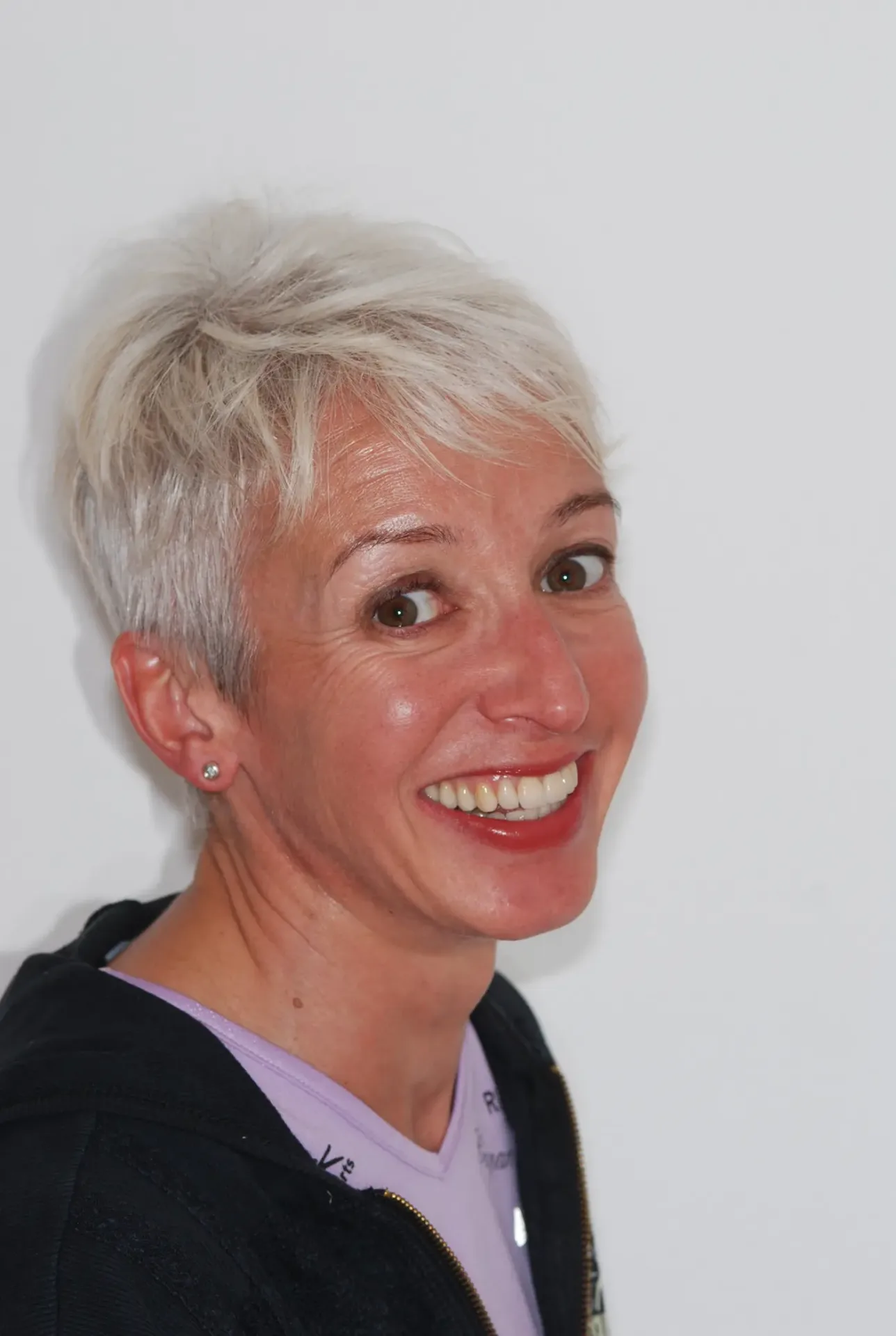 Daniela dopo la riabilitazione estetica e funzionale allo Studio Caneva di Trieste — sorriso naturale