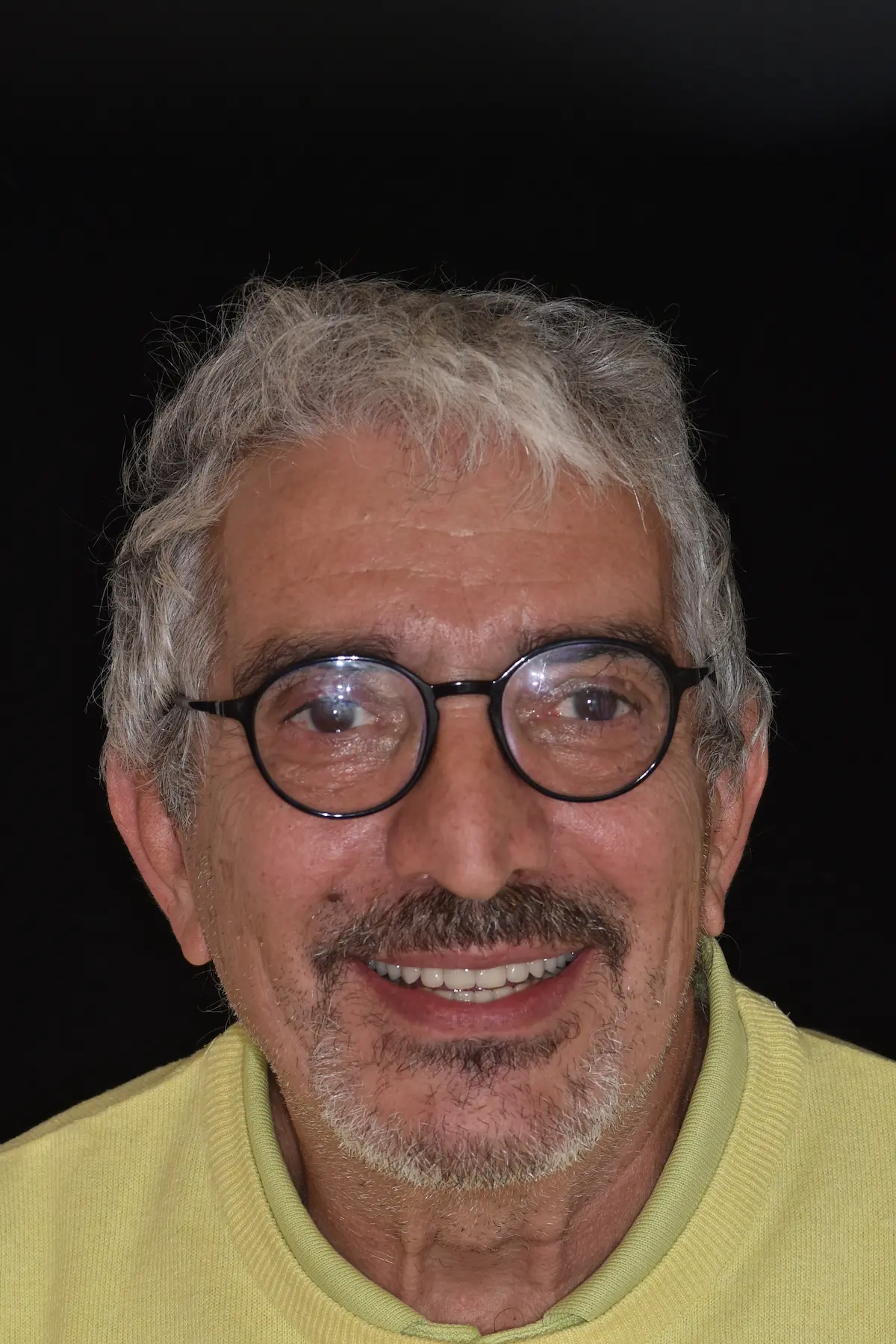Igor sorridente dopo la riabilitazione implantare completa con il Dott. Marco Caneva a Trieste