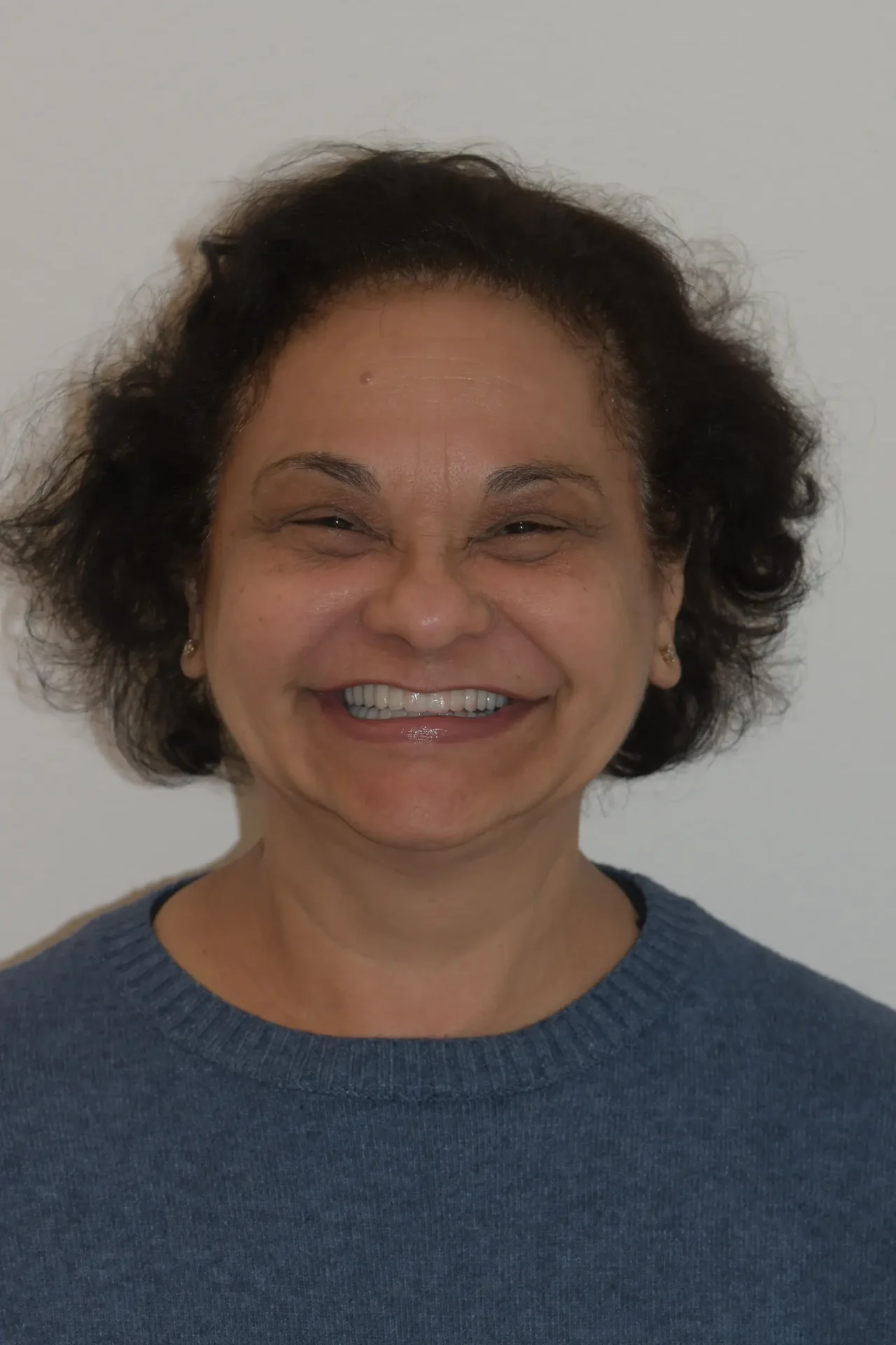 Maria de Fatima dopo la riabilitazione: sorriso pieno e naturale con denti su impianti